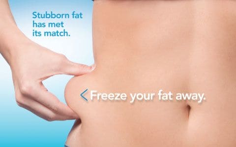 Hips treatment Wooburn Green From Lipo Sculpt