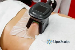 Cryolipolysis Helping You Getting that Perfect Summer Body 3 Cryolipolysis Wooburn Green can give you the best summer body - contact us today!