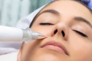 Best Actinic Keratoses Removal 3 Actinic keratoses Wooburn Green solutions - book in today!