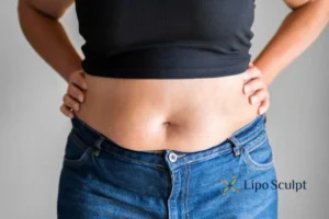 Bidding Farewell to Muffin Tops with Aqualyx Fat Injections 2 Do you wish you could reduce your muffin top Wooburn Green With Aqualy fat dissolving injections you can!
